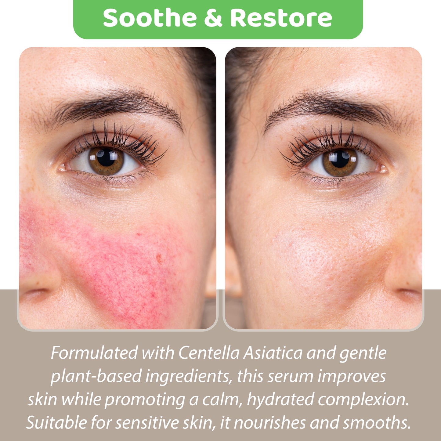 Centella Renew Serum